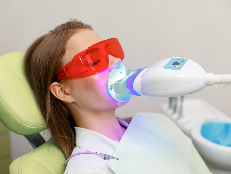 Teeth Whitening Los Angeles